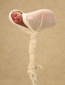 男性不育和精索静脉曲张有什么关系